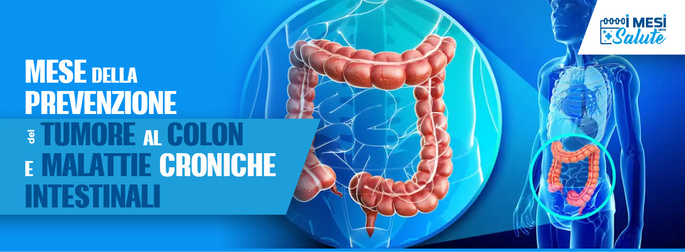 Prevenzione tumore al colon e diagnosi intestinale a Villa Esperia